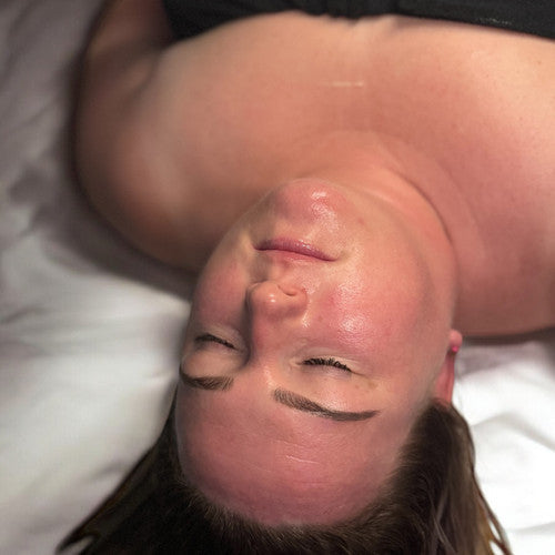 Microneedling Course (Collagen Induction Therapy)